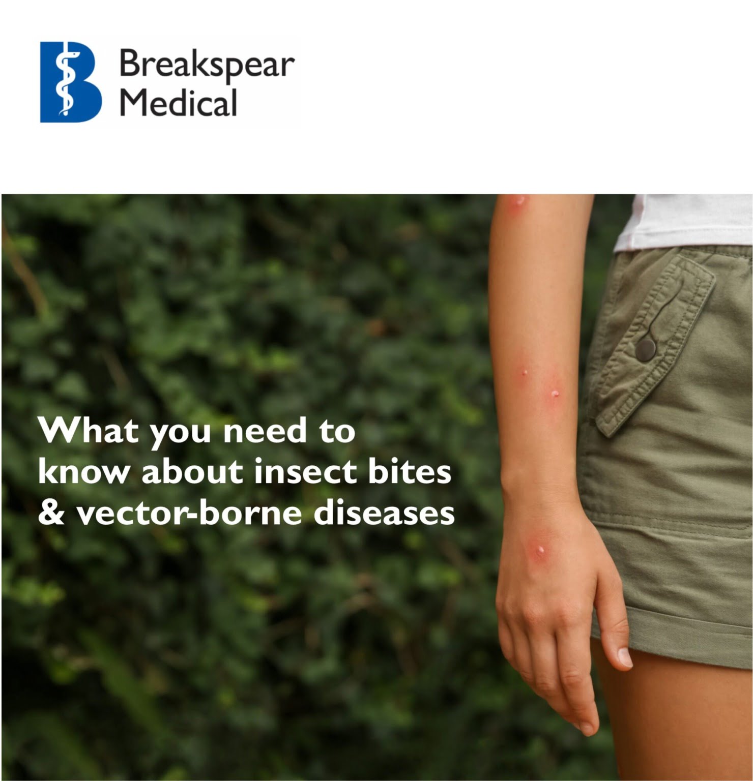 What you need to know about insect bites & vector-borne diseases ...